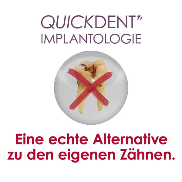 Logo Quickdent Implantologie mit Animation
